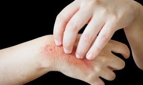 Flea Pest Control Haslemere 3 Flea Pest Control Haslemere - Keep Away